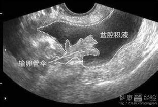 一、先说一句话
