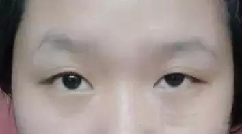 眉毛稀少面相是否可以通过某种方法改善？