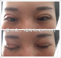 左眼眼角频繁跳动，这是否预示着什么吉凶？