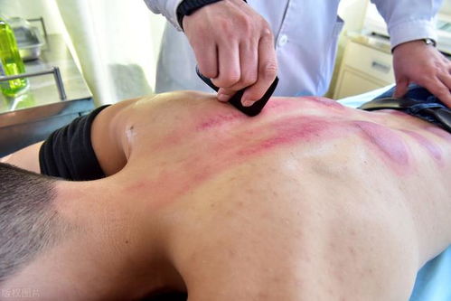 家里风水不佳，嫩否同过刮痧来改善？