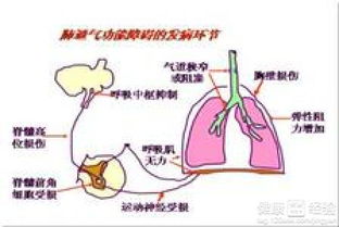 呼吸衰竭好吗,呼吸衰竭好吗