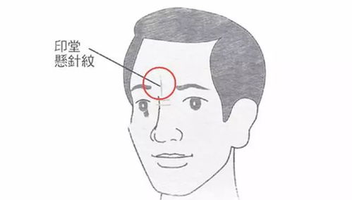 医美大法好！打针就能转运？