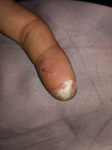 手指划伤见血，真的预示着不幸的事情要发生吗？