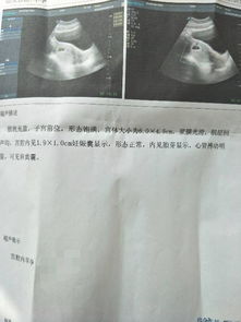 (一) 起名字时常踩的坑——别让你的宝宝背负「负能量」