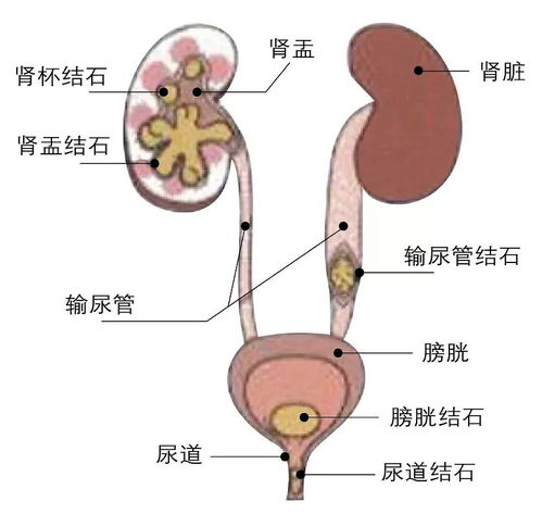 怎样判断自己有没有需要更换或取出环形避孕器？
