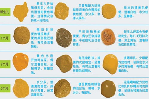 排便频率：每天一次就说明你是个小仙女？