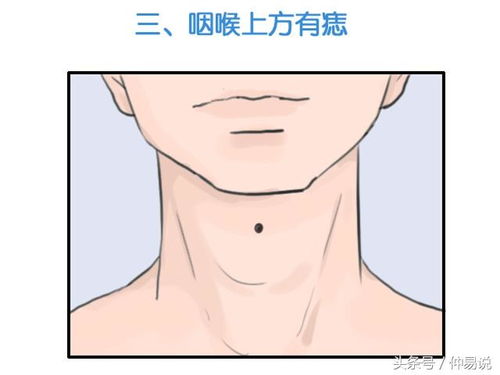 二、 2026年最旺财的痣位大公开