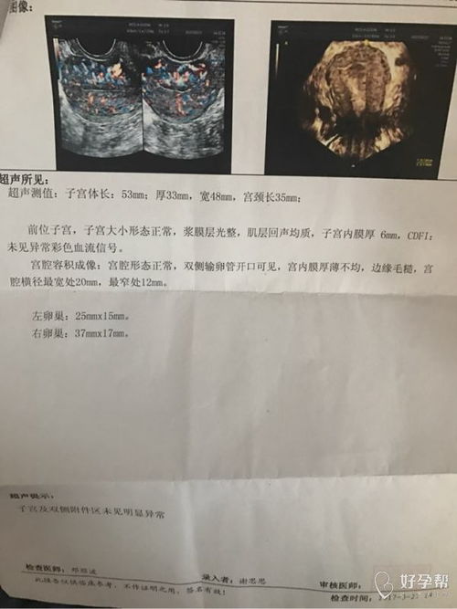 我到底该不该去呢？