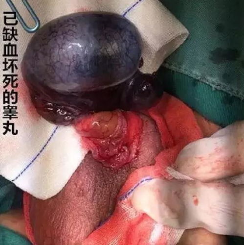 五行缺损：木火土金水