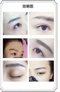为什么左边眉毛眉头从黑色变成白色了一边眉毛一边白一边黑的原因是什么？