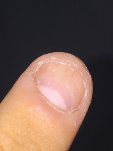 一、 剪指甲与姓名之间的微妙关系