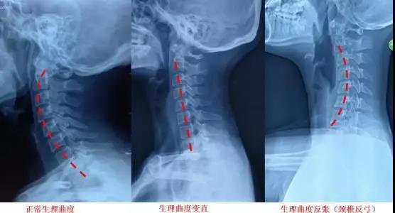 1.1 五行与肩胛