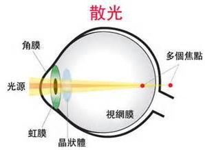 风水对眼睛产生的影响,风水对眼睛产生的影响