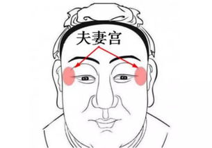 女性夫妻宫凹陷的影响