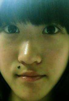 一、 前言：痣相与星宿的奇妙交叉