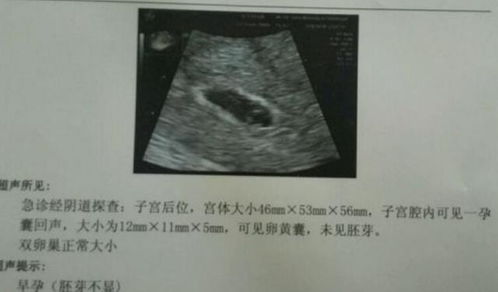(二) 改名字时需要注意哪些「细节」 —— 不是随便换就行