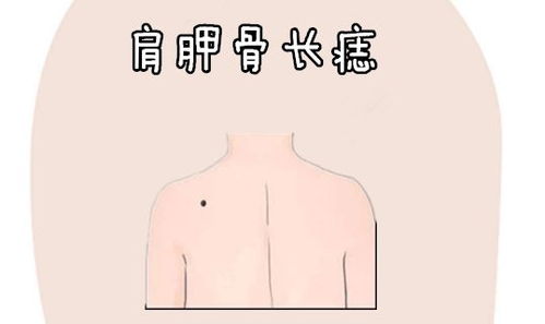 人的富贵痣长在哪些位置福气满满？