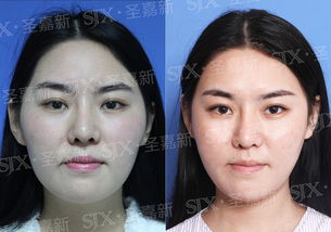 高颧骨的优势：成熟与气场
