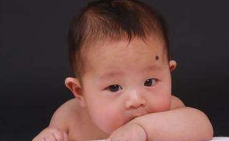 震惊！这10个部位的胎记藏着惊天秘密，2026年运势大爆发！