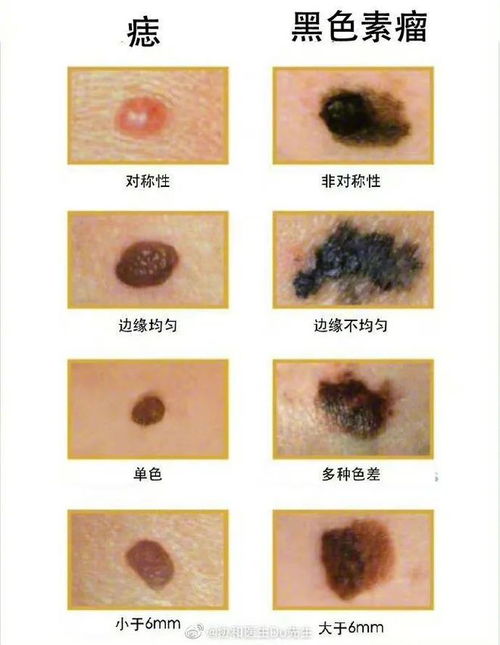 一、外观特征的细致看看