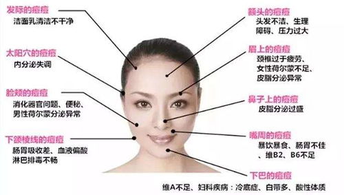 脸上和身上同时长痘是什么原因引起的？