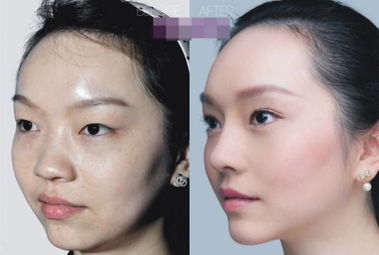 女生整容后会对家中的风水产生怎样的影响呢？
