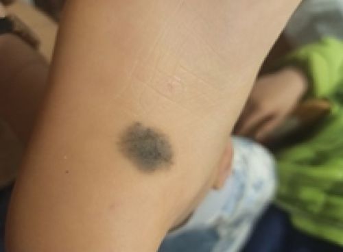 男人胸前三颗红痣分别代表什么含义？