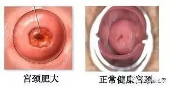 一、白带增更多：这到底是怎么回事？