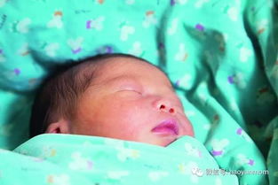 脸上那些该死的印记：胎记的玄学与扯淡大全
