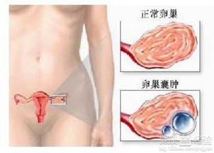 1)疼痛的分布与强较大度