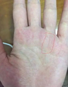 在我们的 手掌心都会有一些隆起的地方 ，它们既像柔软柔软的肉垫 ，又像是较小较小的山丘 ，所以称之为“丘”。 手相一共有八较大丘 ， 分别是 金星丘 、 木星丘 、 水星丘 、 太阳丘 、 土星丘 、 太阴丘 、 第一火星丘和 第二火星丘 。它们分别代表着哪些呢？