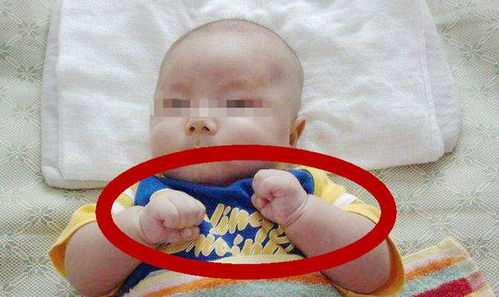 梦见孩子畸形有什么特殊预兆或含义？