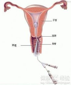 2.2 免疫调节——从内部清除自我袭击者