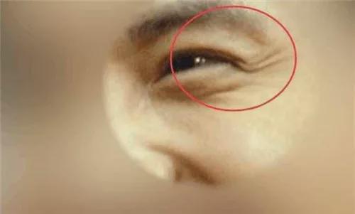 天呐！鱼尾纹深浅暴露未来财富密码