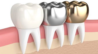 为哪些说月经期不宜洗牙？