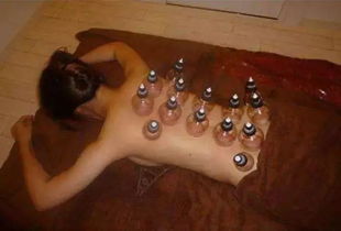 误入相声现场の拔罐奇遇