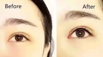 男眉头间有两条八字纹，这眉头的二道纹究竟代表什么含义？