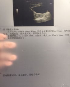 一、停经35天：那到底是怎么回事？