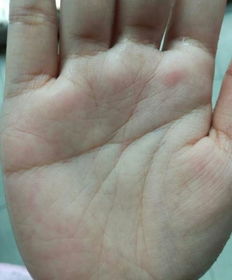 算命说我和前夫婚姻线没断，女人婚姻线尾部分叉会影响再婚吗？