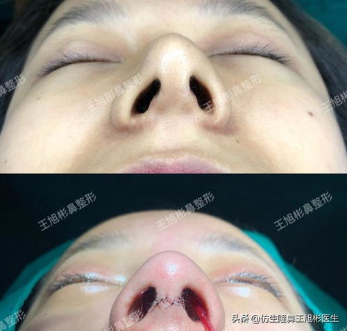 风水好的鼻子长什么样,风水好的鼻子长什么样