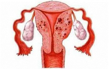 子宫疾病与风水之间是否存在关联性？