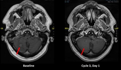 第三弹：口味突变之谜