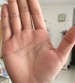 二、 看掌丘的形状