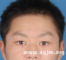 眉骨胎记=朋友遍天下？呵呵