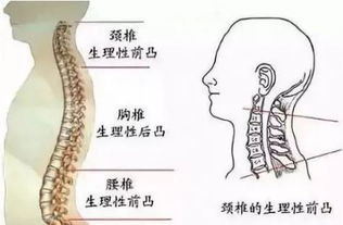 六、蛇年“缠绕”——趴桌子上睡觉&空调直吹寒气侵袭