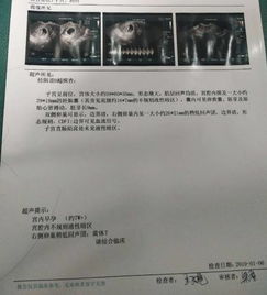 孕囊的谜团：生命伊始的困惑