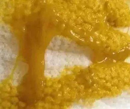 啥是“正常”的大便？先有个概念