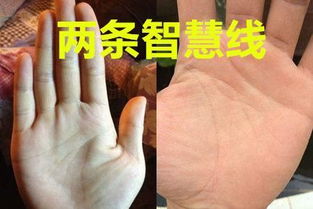 解读智悲绒的不同形态