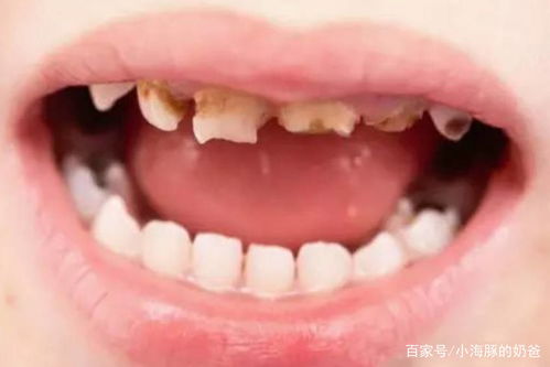 四、健康警报：口腔与全身疾病的千丝万缕联系（或着根本没有）