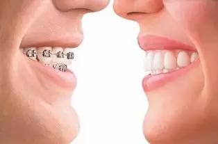 二、关于“大门牙”和“小门牙”的传说——真的有牙吗？